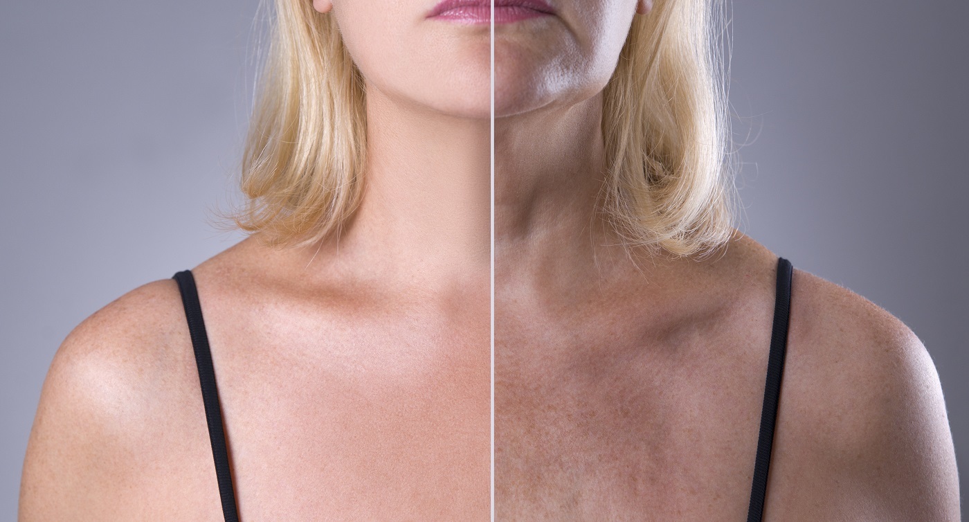 кожа на груди у женщин фото 7